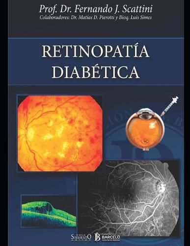 Cover image for Retinopatia diabetica: Oftalmologia