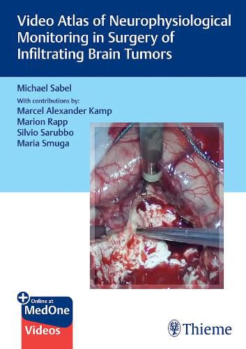 Cover image for Video Atlas of Neurophysiological Monitoring in Surgery of Infiltrating Brain Tumors