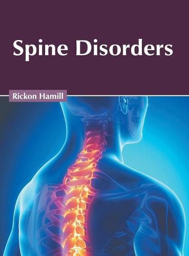 Cover image for Spine Disorders