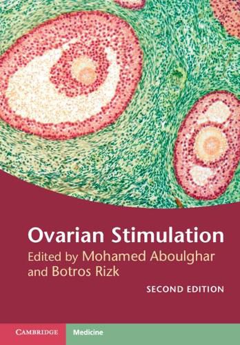 Cover image for Ovarian Stimulation