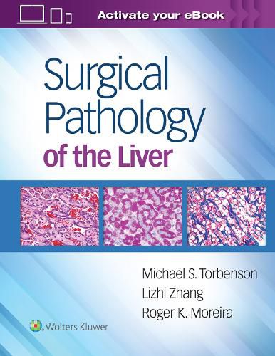 Cover image for Surgical Pathology of the Liver