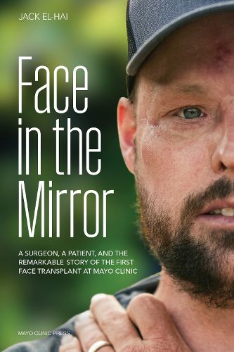 Cover image for Face Transplant