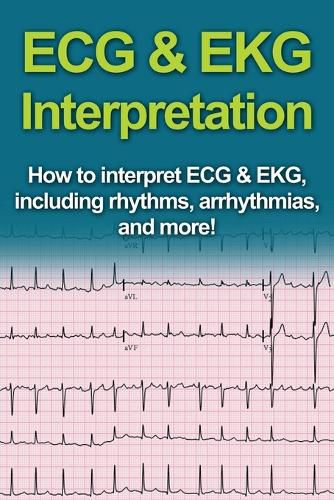 Cover image for ECG & EKG Interpretation: How to interpret ECG & EKG, including rhythms, arrhythmias, and more!