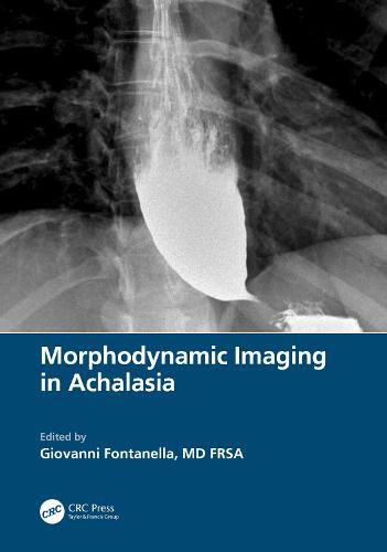 Cover image for Morphodynamic Imaging in Achalasia