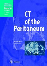 Cover image for CT of the Peritoneum