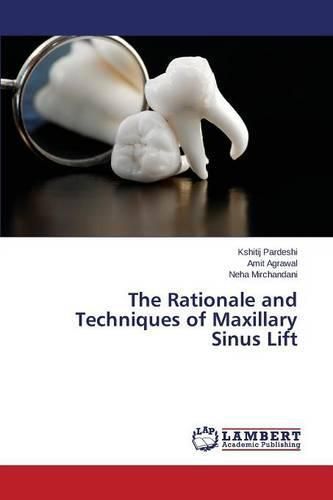 Cover image for The Rationale and Techniques of Maxillary Sinus Lift