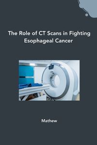 Cover image for The Role of CT Scans in Fighting Esophageal Cancer