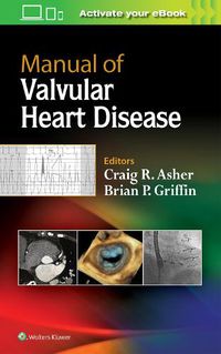 Cover image for Manual of Valvular Heart Disease