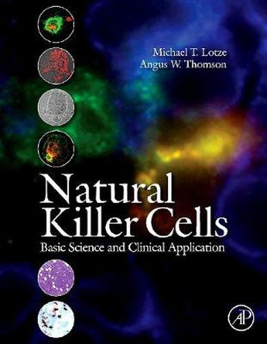 Cover image for Natural Killer Cells: Basic Science and Clinical Application