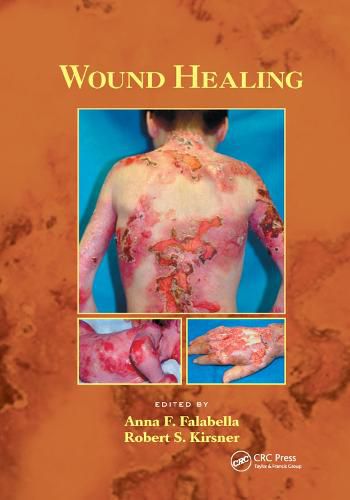 Cover image for Wound Healing