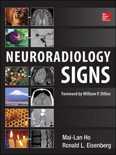 Cover image for Neuroradiology Signs