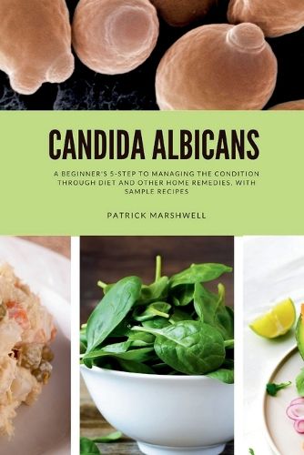 Cover image for Candida Albicans