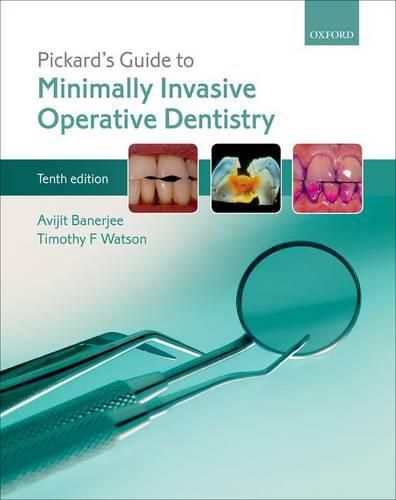 Cover image for Pickard's Guide to Minimally Invasive Operative Dentistry