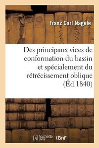 Cover image for Des Principaux Vices de Conformation Du Bassin Et Specialement Du Retrecissement Oblique