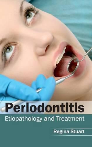 Cover image for Periodontitis: Etiopathology and Treatment