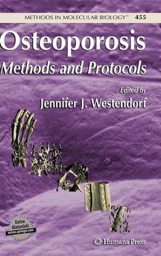 Cover image for Osteoporosis: Methods and Protocols