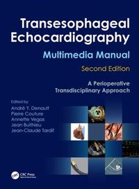 Cover image for Transesophageal Echocardiography Multimedia Manual: A Perioperative Transdisciplinary Approach