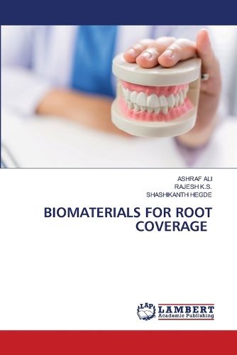 Cover image for Biomaterials for Root Coverage