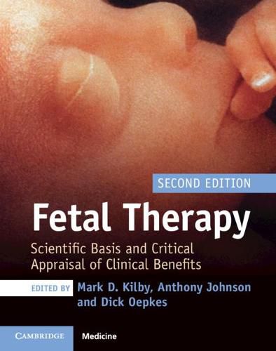 Cover image for Fetal Therapy: Scientific Basis and Critical Appraisal of Clinical Benefits