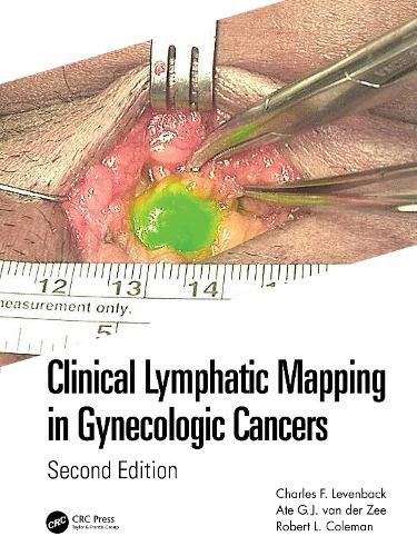 Cover image for Clinical Lymphatic Mapping in Gynecologic Cancers