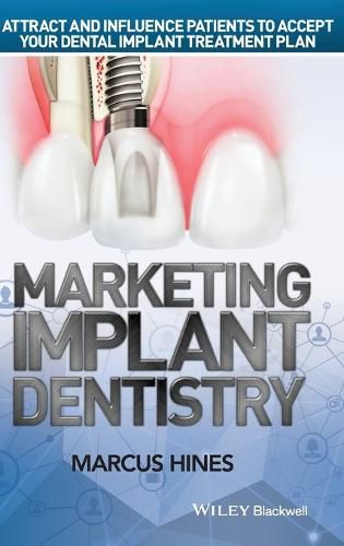 Cover image for Marketing Implant Dentistry - Attract and Influence Patients to Accept Your Dental Implant Treatment Plan