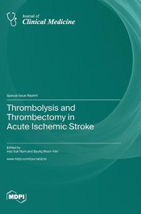 Cover image for Thrombolysis and Thrombectomy in Acute Ischemic Stroke