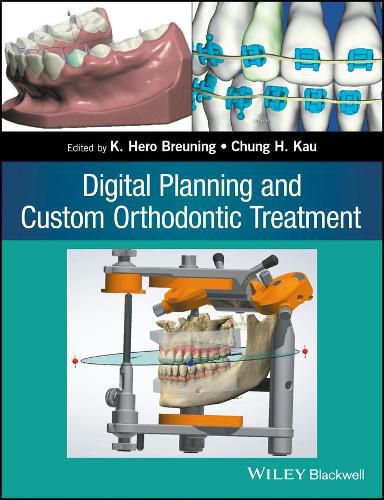 Cover image for Digital Planning and Custom Orthodontic Treatment