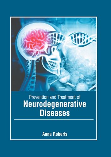 Cover image for Prevention and Treatment of Neurodegenerative Diseases