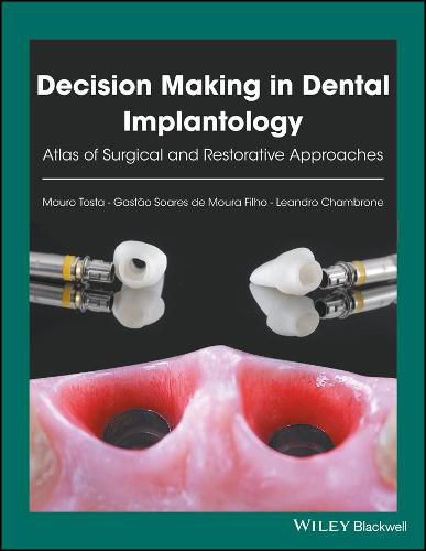 Cover image for Decision Making in Dental Implantology - Atlas of Surgical and Restorative Approaches