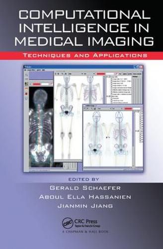 Cover image for Computational Intelligence in Medical Imaging: Techniques and Applications