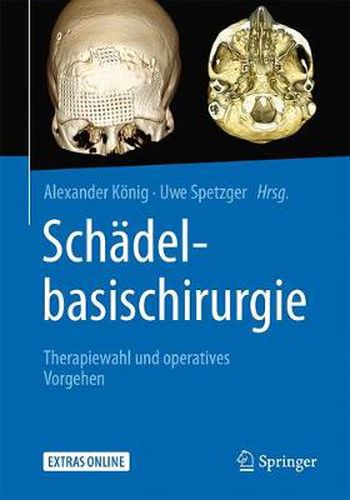 Cover image for Schadelbasischirurgie: Therapiewahl Und Operatives Vorgehen