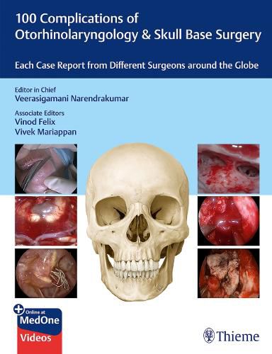 Cover image for 100 Complications of Otorhinolaryngology & Skull Base Surgery