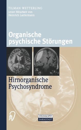 Cover image for Organische Psychische Storungen: Hirnorganische Psychosyndrome