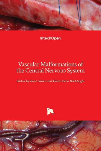 Cover image for Vascular Malformations of the Central Nervous System