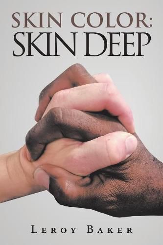 Cover image for Skin Color: Skin Deep