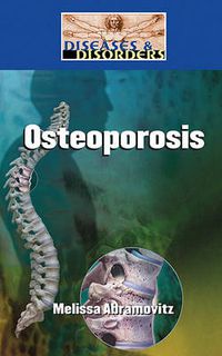 Cover image for Osteoporosis