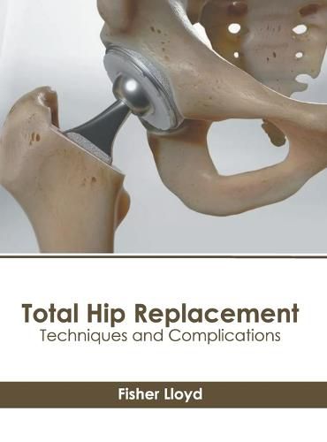 Cover image for Total Hip Replacement: Techniques and Complications