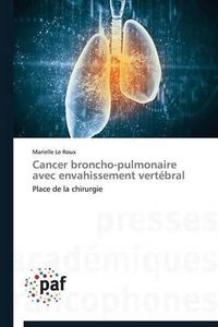 Cover image for Cancer Broncho-Pulmonaire Avec Envahissement Vertebral