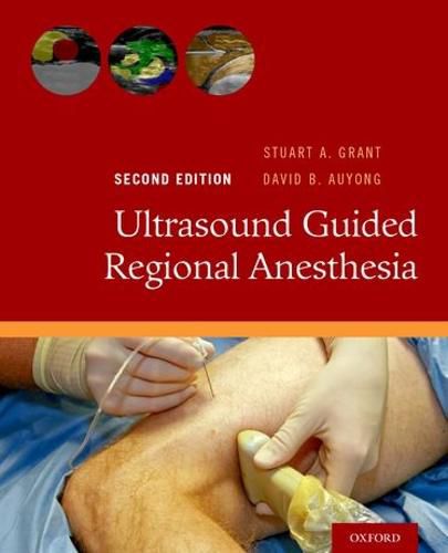 Cover image for Ultrasound Guided Regional Anesthesia