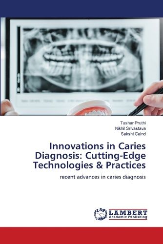 Cover image for Innovations in Caries Diagnosis