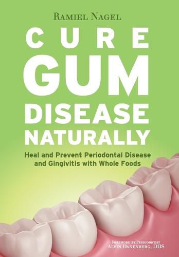 Cover image for Cure Gum Disease Naturally: Heal Gingivitis and Periodontal Disease with Whole Foods