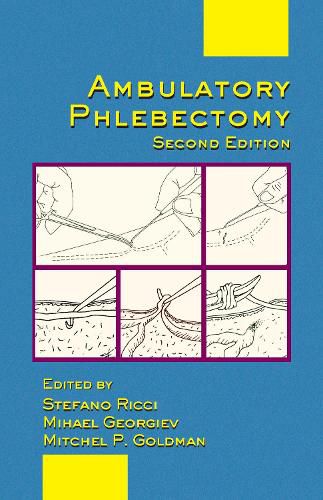 Cover image for Ambulatory Phlebectomy