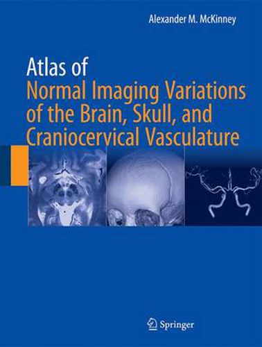 Cover image for Atlas of Normal Imaging Variations of the Brain, Skull, and Craniocervical Vasculature