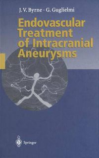 Cover image for Endovascular Treatment of Intracranial Aneurysms