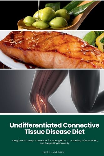 Cover image for Undifferentiated Connective Tissue Disease Diet