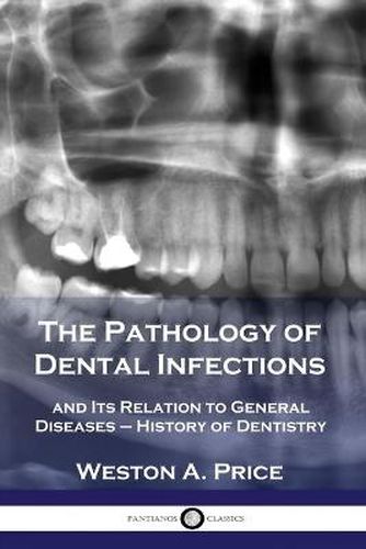 Cover image for The Pathology of Dental Infections: and Its Relation to General Diseases - History of Dentistry
