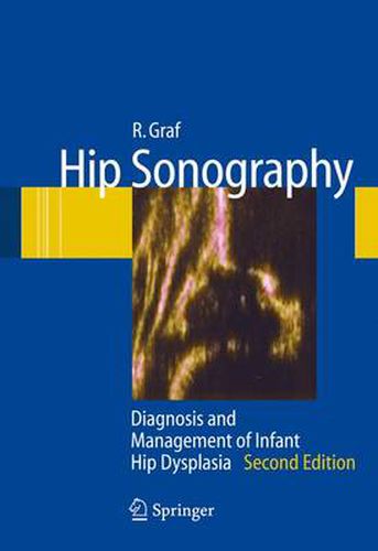 Cover image for Hip Sonography: Diagnosis and Management of Infant Hip Dysplasia