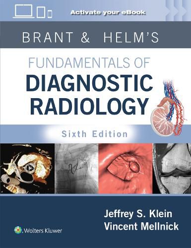 Cover image for Brant & Helms' Fundamentals of Diagnostic Radiology: Print + eBook with Multimedia