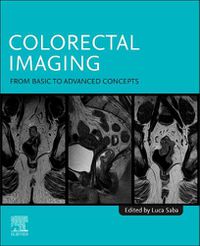 Cover image for Colorectal Imaging