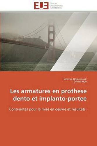 Cover image for Les Armatures En Prothese Dento Et Implanto-Portee